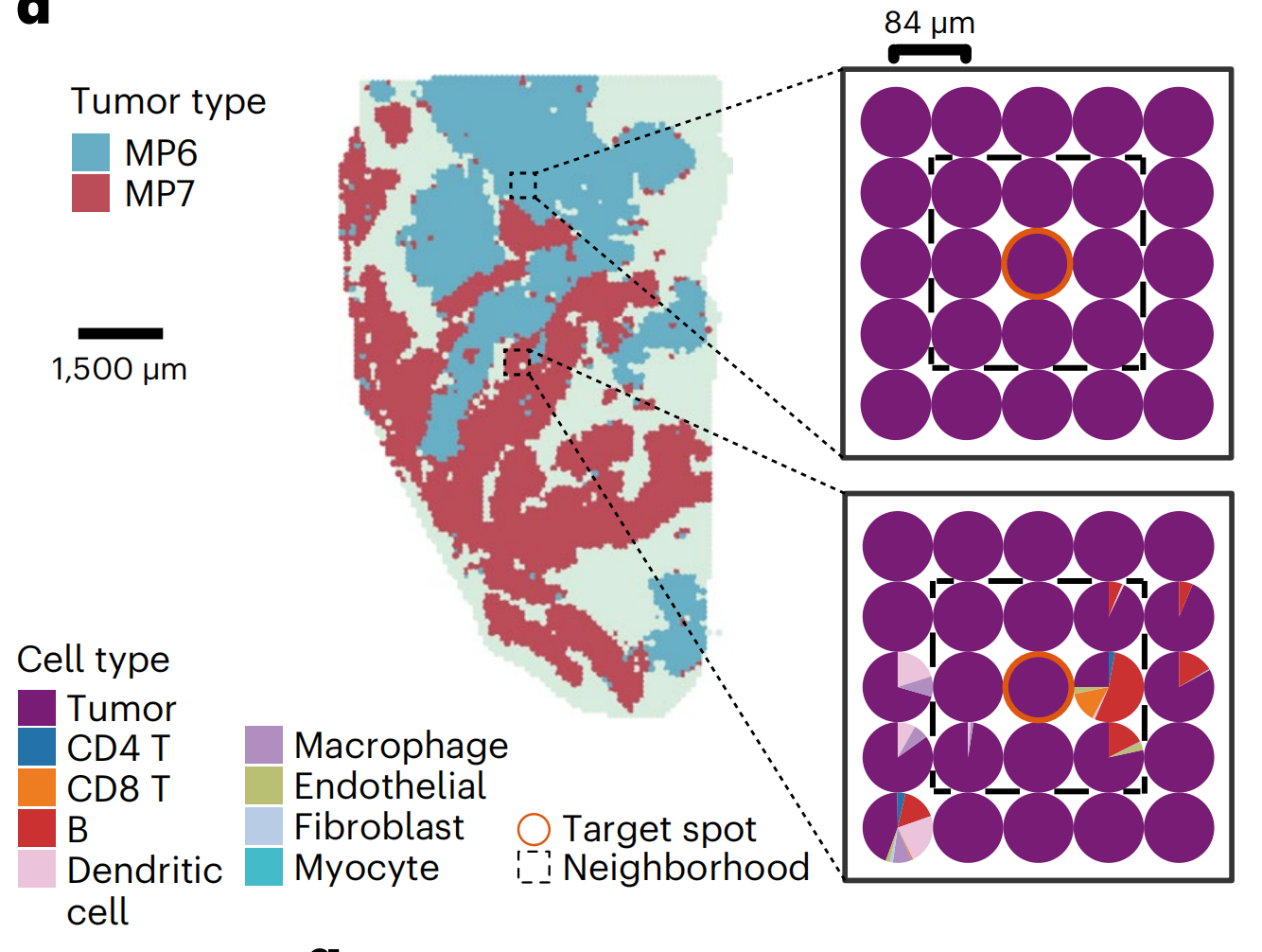 Figure 4. Stereo-seq revealed that MP6 and MP7 states occupy spatially distinct tumor regions. Source: Fan et al., Nature Genetics (2023).